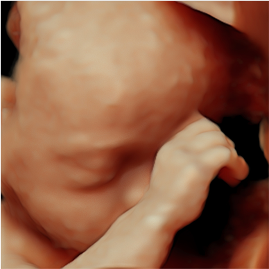 Reveal Hidden Details And Enrich Clinician-patient - Baby (560x387), Png Download