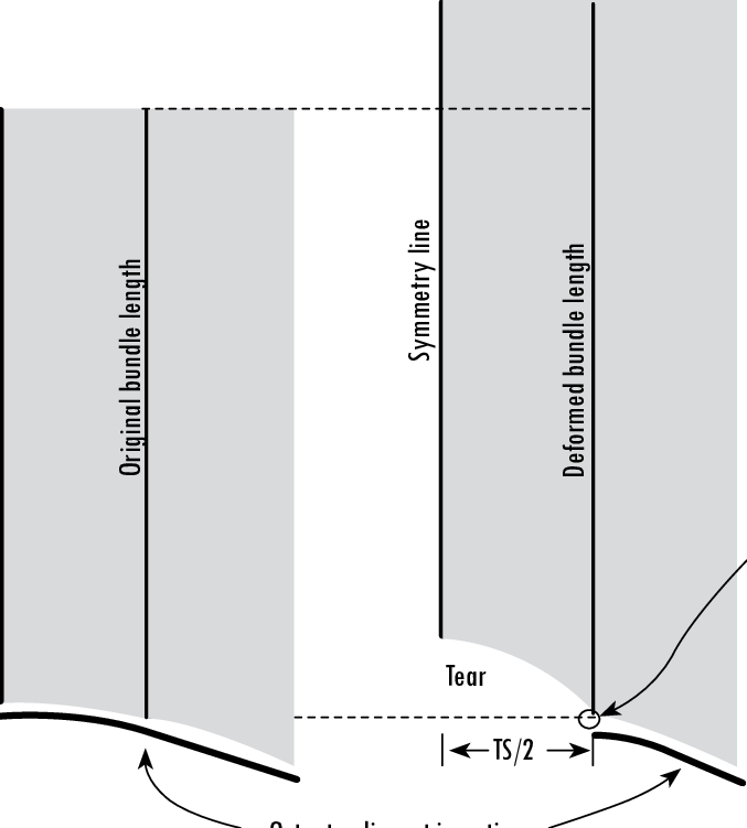 Failure Of The Tear Edge Fiber Bundle At Tendon Ultimate - Tendon (677x751), Png Download