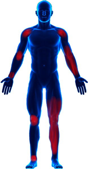 Sore Muscle Png - Body Pain Images Png (320x600), Png Download