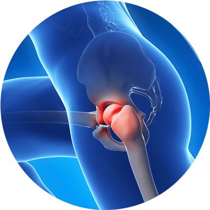 Relieve Hip Pain Without Surgery - Hip Pain Png (450x450), Png Download