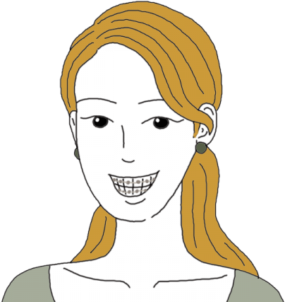 Teeth Or Tooth Dreams - Dental Braces (450x450), Png Download