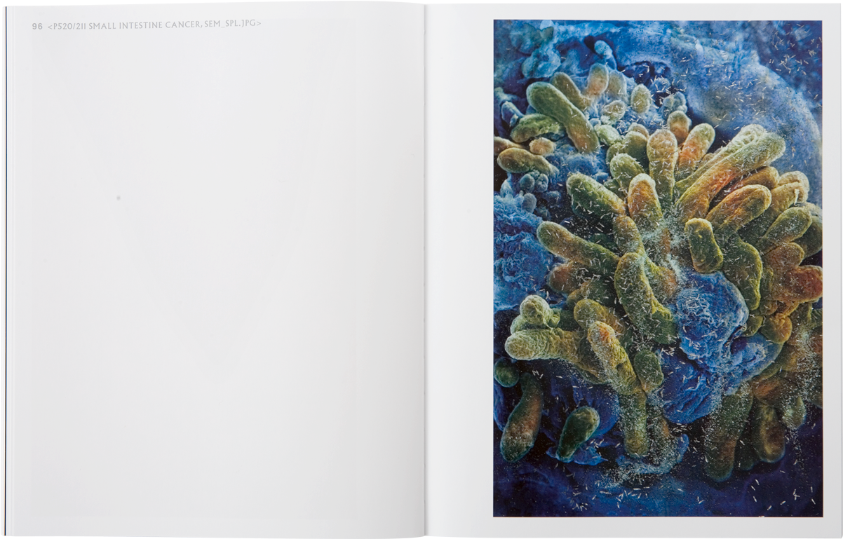 Damien Hirst Beyond Belief Catalogue - Small Intestine, Sem - Rectangle Magnet (1201x1201), Png Download