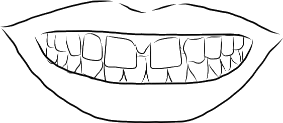 Gapped Teeth - Line Art (582x321), Png Download