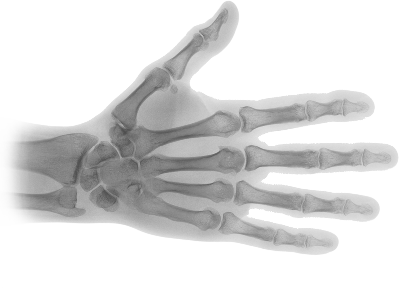 X Ray Transparent Png (800x584), Png Download
