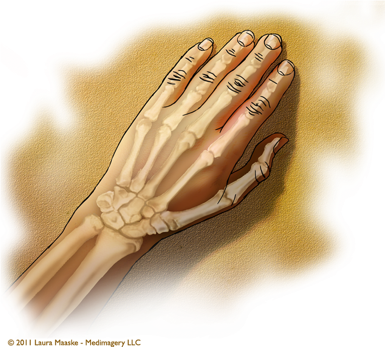 Medical Illustrations Laura Maaske Medical Illustrator - Ligament (773x765), Png Download