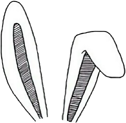 Tumblr Tumblrgirl Ears Bunnyears Cute Stickers Art - Bunny Ears Overlays Png (532x518), Png Download