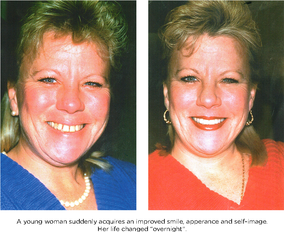 A Young Woman Suddenly Acquieres A New Smile - Woman (960x800), Png Download