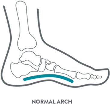 A Kids Foot Health Diagram Illustrating A Normal Arch - Illustration (451x480), Png Download