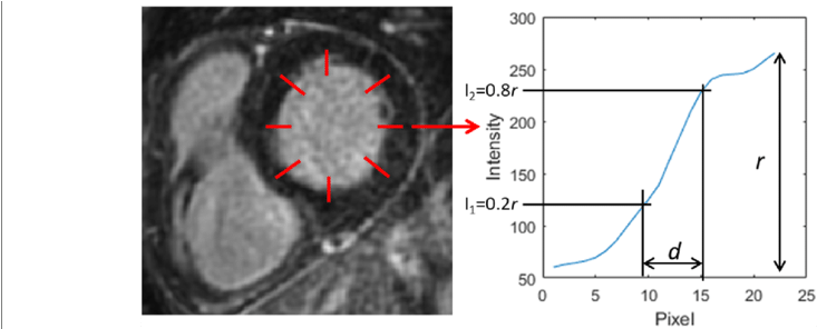 Example Of Endocardial Border Sharpness Analysis In - Diagram (850x295), Png Download