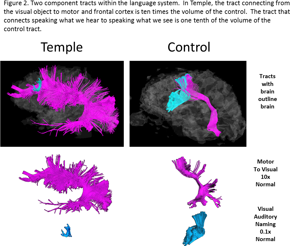 Brain Outline Png (1029x868), Png Download