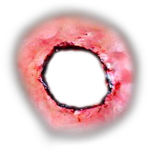 Wound Ferita Hole Blood Sticker By Go - Wound (681x687), Png Download