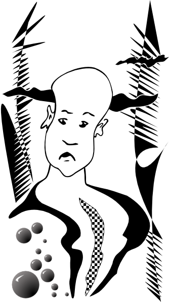 Bald Man Clip Art At Clker - Hair Loss (336x597), Png Download
