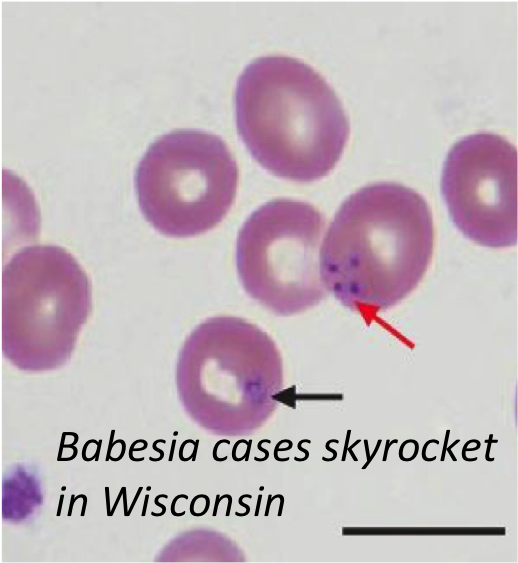 The Rising Prevalence Of Co Infections In Rodents May - Babesia Peripheral Blood Smear (517x663), Png Download