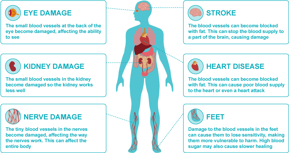Damage Png - Problems Can Diabetes Cause (1000x530), Png Download