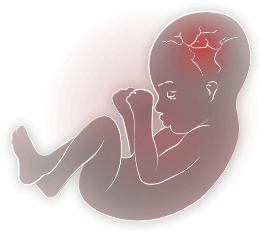 Baby In Womb Png Transparent Baby In Womb - Transparent Baby In Womb (536x477), Png Download