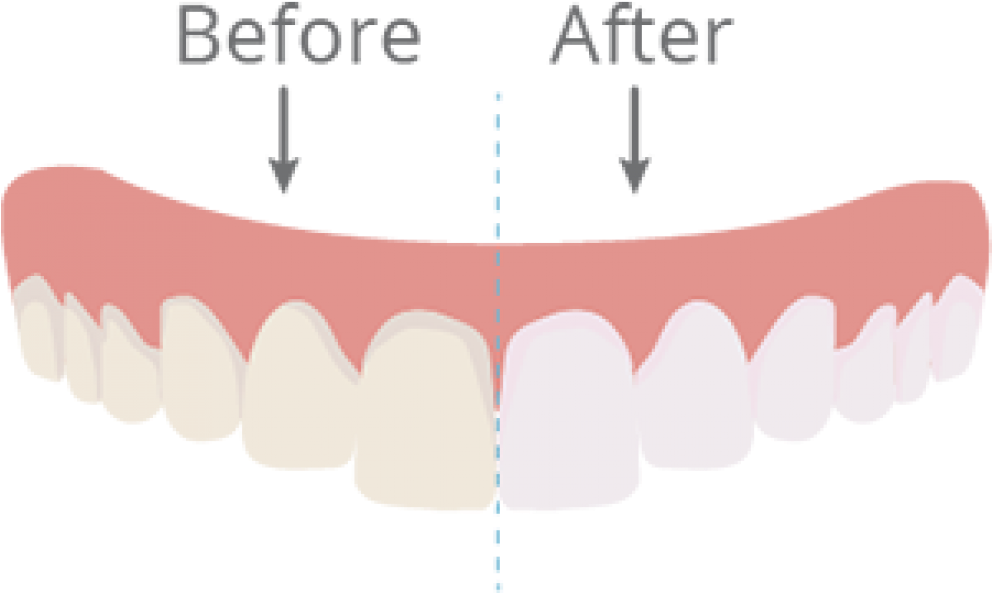 Diagram (991x601), Png Download