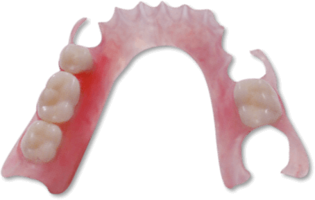 Flexible Partial Dentures - Hillock Family Dental (454x289), Png Download