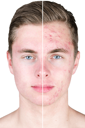 Beaute Pacifique Scars And Stripes (282x426), Png Download