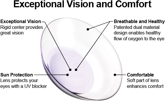 Overview - Duette Contacts (620x423), Png Download