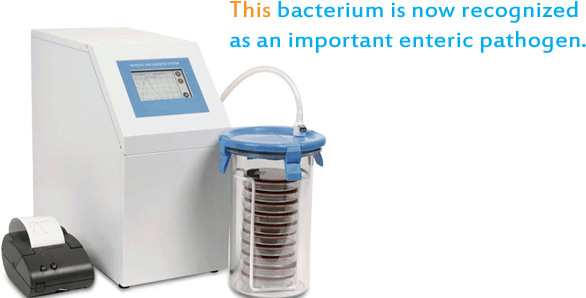 Anaerobic Jar - Anaerobic Work Station (630x320), Png Download