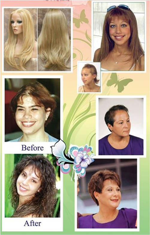 For A Person With Medical Conditions Such As Alopecia, - Full Lace Wigs (700x800), Png Download