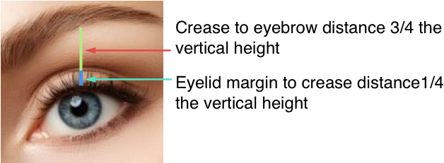 Eye Lift Women Diagram - Eyelid (826x369), Png Download