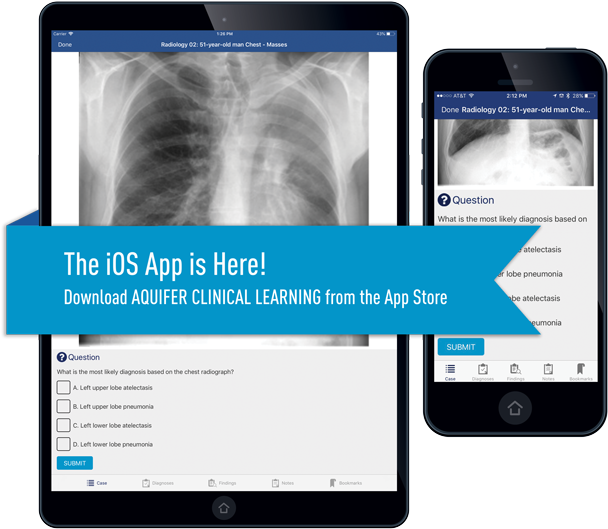 Aquifersm Clinical Learning - Ios (700x584), Png Download