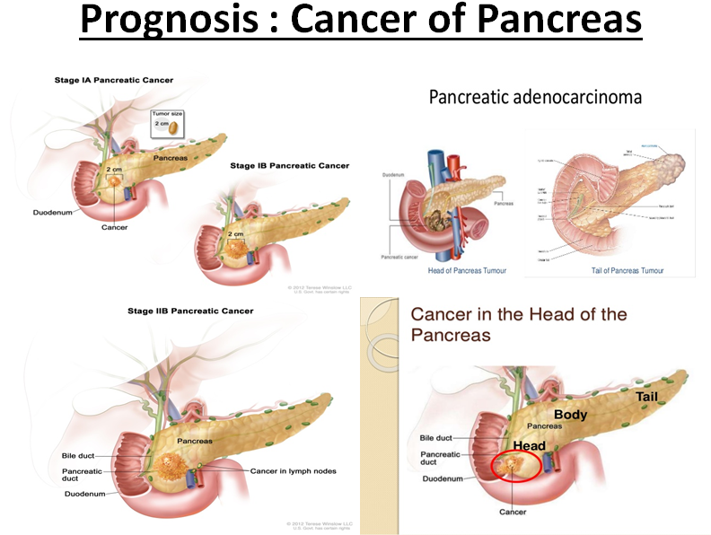 Prognosis (900x624), Png Download