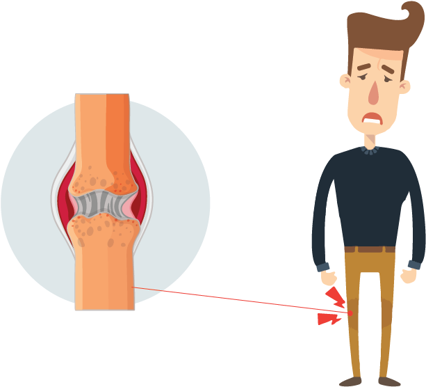 Discover Ayurvedic Cure For Medial Meniscal Tear, The - Body Ache (842x595), Png Download
