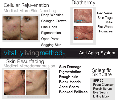 What Is The Best Treatment For Acne Scars - Diathermy And Acne (468x419), Png Download