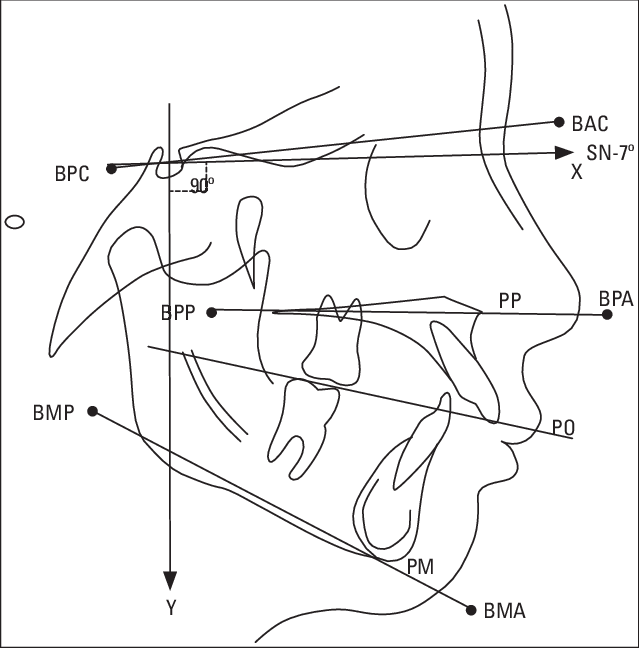 Pontos Fiduciais, Planos E Linhas Cefalométricas - Planos Cefalométricos (639x648), Png Download