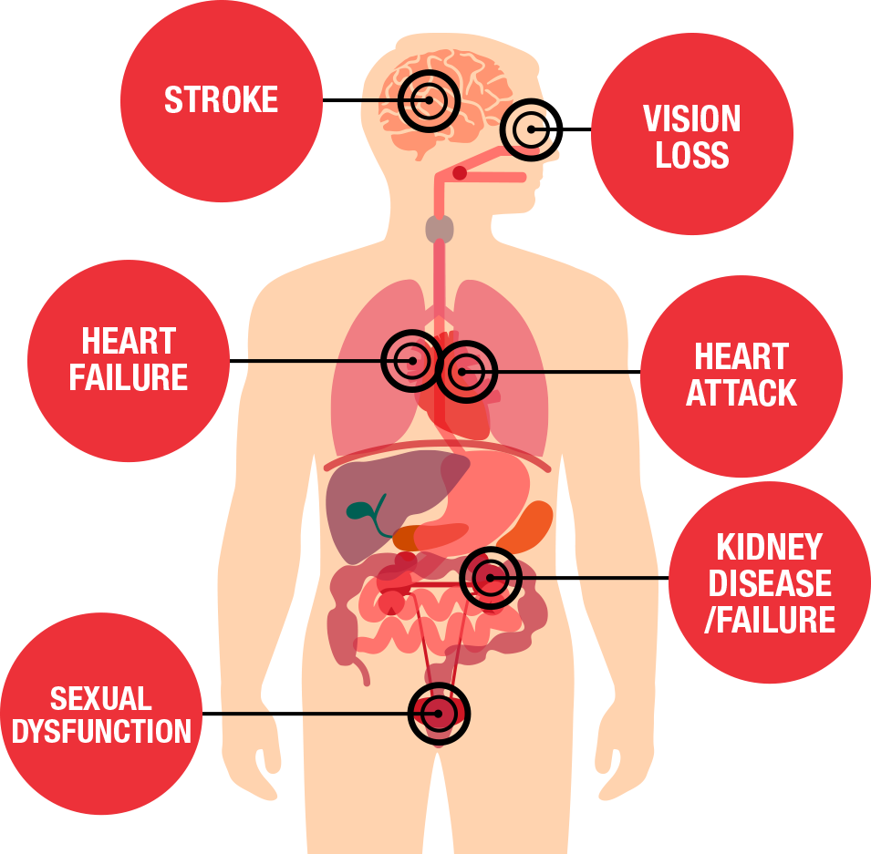 Health Threats Diagram - High Blood Pressure Effects (955x937), Png Download