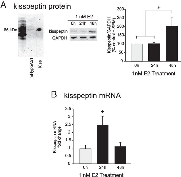 E2 Induces Kisspeptin In Mhypoa51 Neurons - Kisspeptin (708x690), Png Download