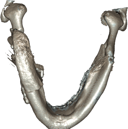 Ct-2 - Body Jewelry (465x463), Png Download