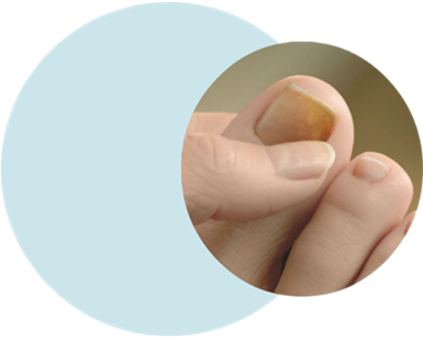 Varpaan Kynnen Alla Valkoista (380x380), Png Download