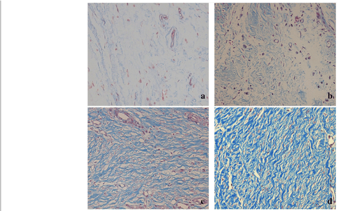 Histological Images Of Collagen Tissue Hyperplasia - Tile (850x427), Png Download