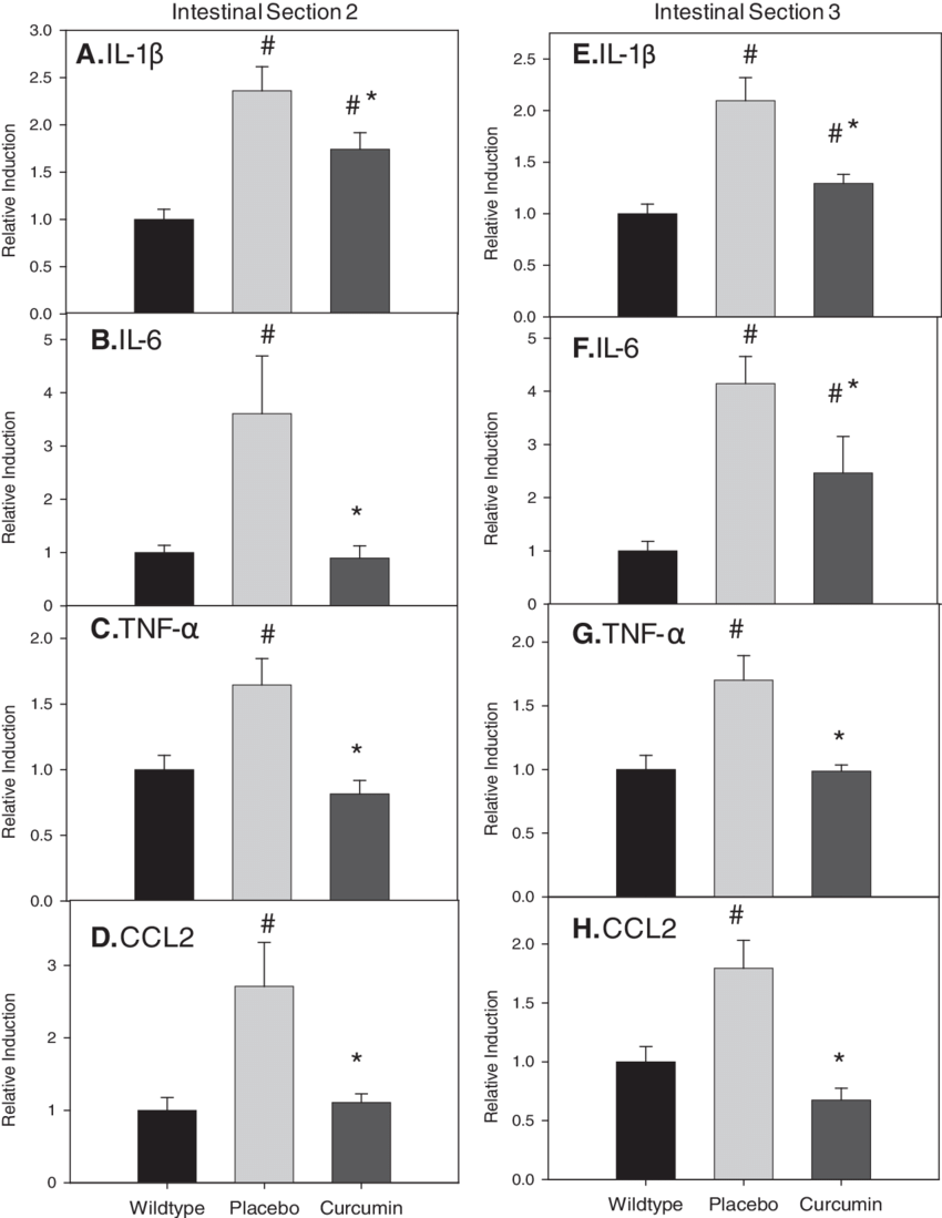 Curcumin Blunts Increased Mrna Expression Of Interleukin - Monochrome (850x1099), Png Download