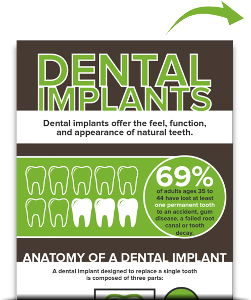 Dental Implants Muncie - Dental Implant Offers (500x600), Png Download