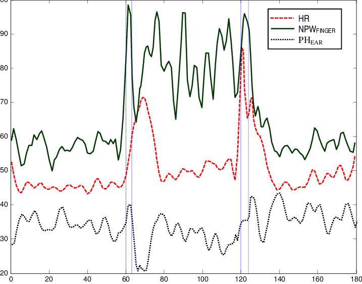 Filtered Heart Rate , Normalized Pulse Width (npw Finger - Heart Rate (717x562), Png Download