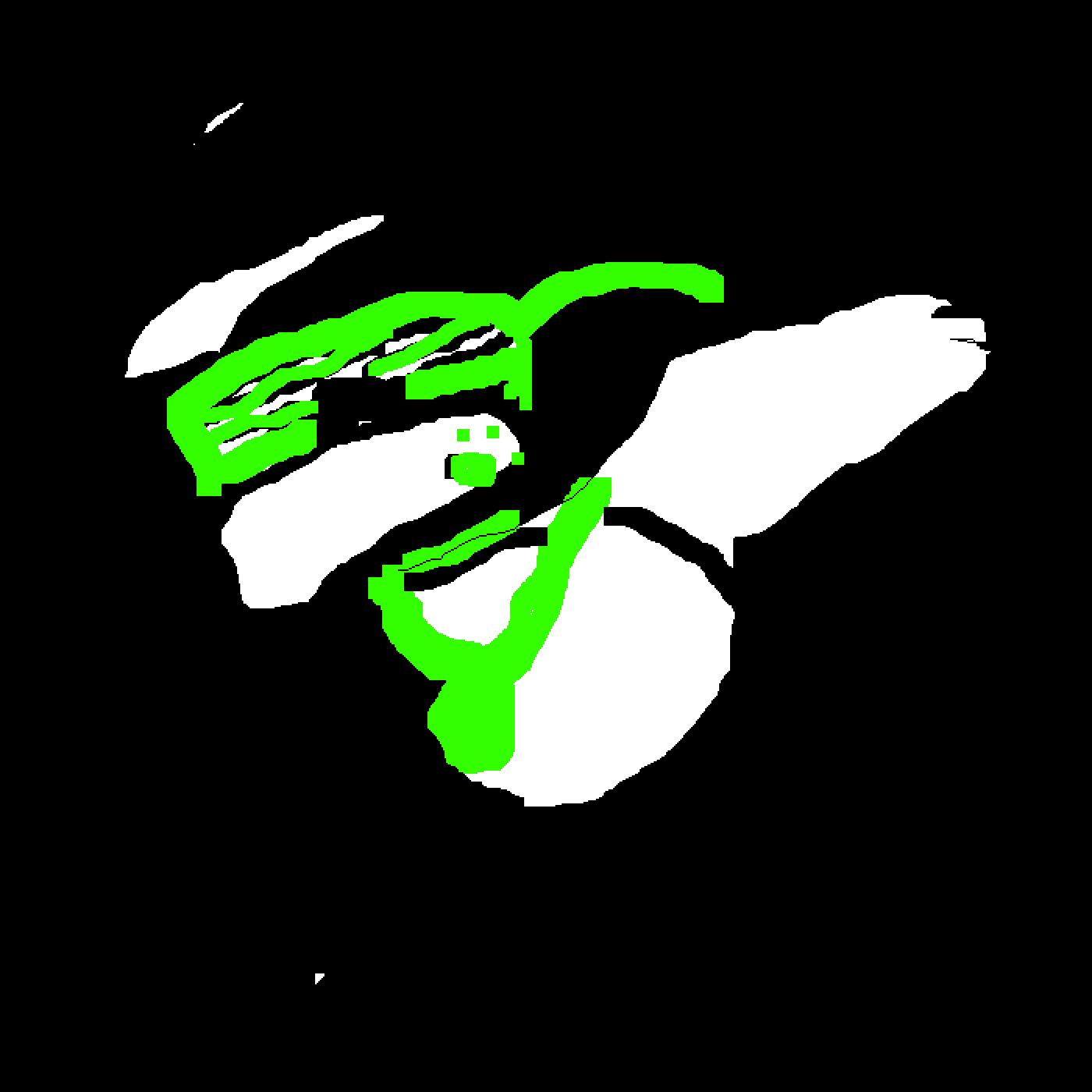 Pixilart Dark Dabbing Panda Xanxiety Png Transparent - Graphic Design (1400x1400), Png Download