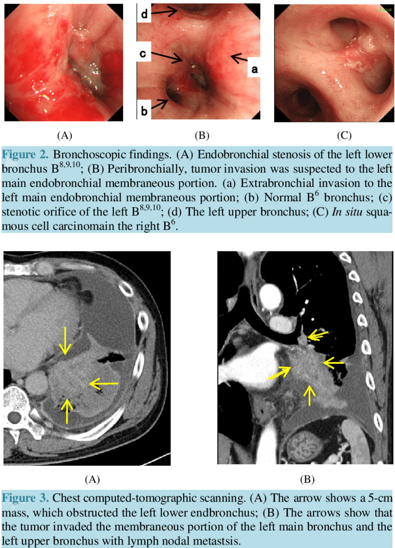 Chest X - Library (850x1089), Png Download