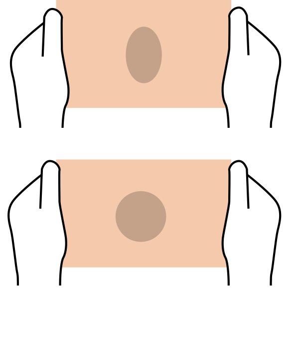 Correct Size Bandage, Correct Stretch Bandage - Pressure System Urgo K2 (600x699), Png Download