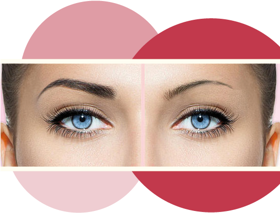 Que Significa Micro Perfilado) Es La Última Técnica - Microblading Side By Side (551x451), Png Download