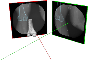 Processing Requires A Hi Res Ct Scan Of The Subject, - Radiology (493x272), Png Download