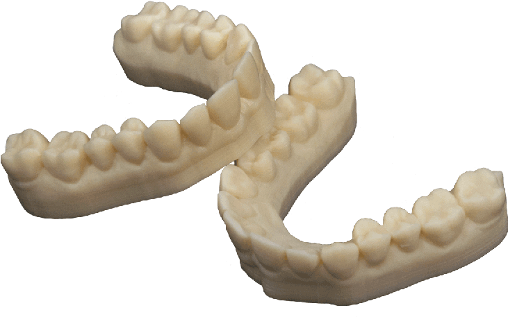 Dental Model By 3d Printing For Dental Crowns & Bridges - 3d Printed Dental Model (800x600), Png Download
