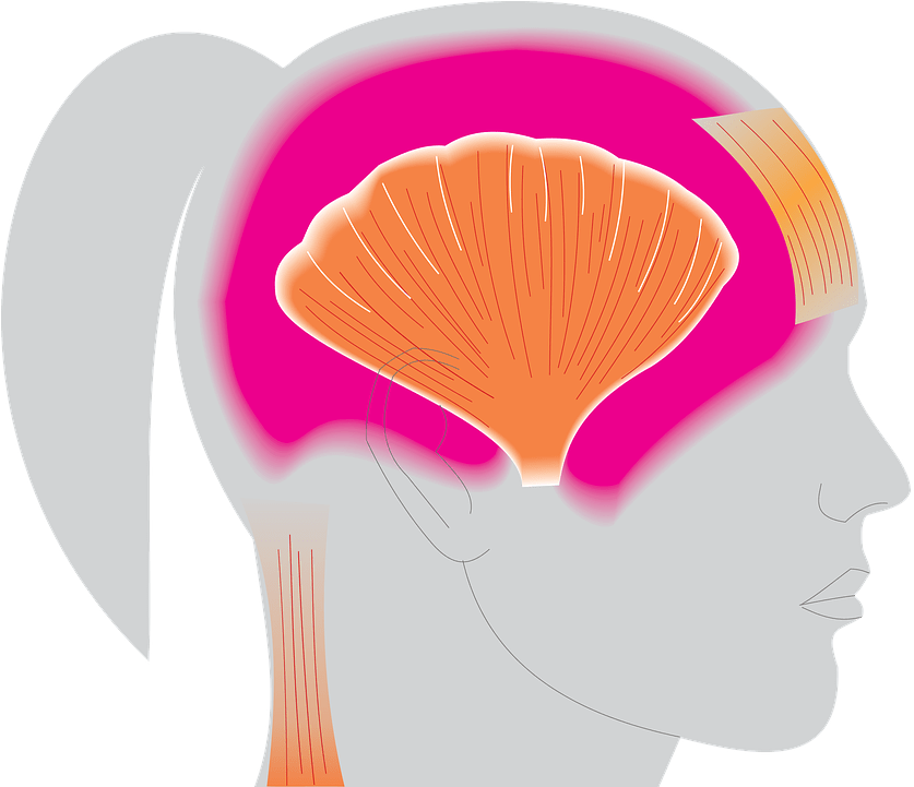 2w2111 Migraines - Migraine (886x720), Png Download