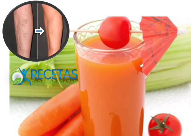 Piernas Cansadas O Hinchadas Y/o Padeces De Varices, - Batido Para La Circulacion (640x443), Png Download