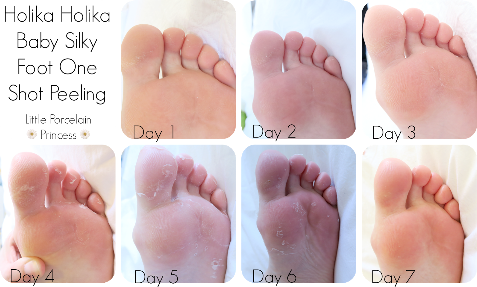 Little Porcelain Princess Fail Or Holy Grail Review - Toe (1600x963), Png Download