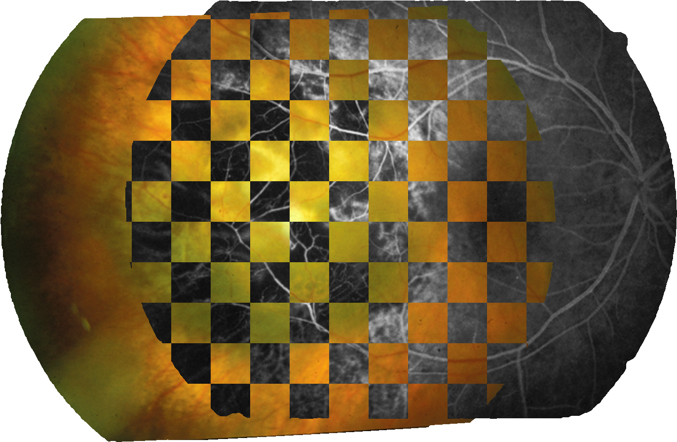 Checkerboard Image - Vans Sk8 Hi Checkerboard 2.0 (1456x990), Png Download