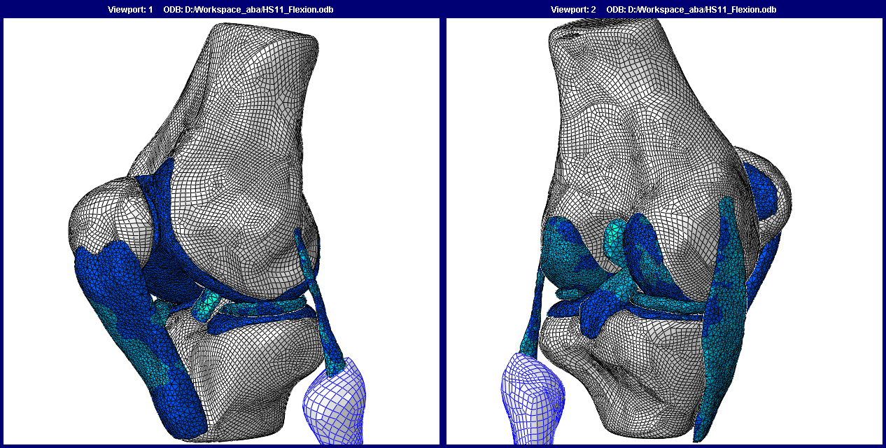 Human Knee Joint Fe Model - Human Knee Finite Element Method (1266x640), Png Download